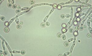 candida-albicans3