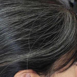 grey-hair