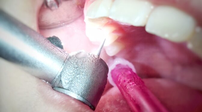 Studies Suggest This New Type of Filling Can Regenerate Your Teeth